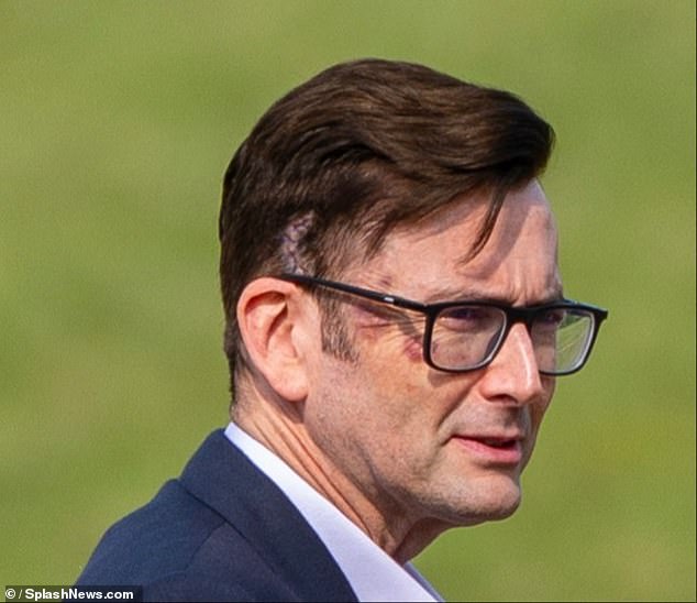 In a shock turn of events, David Tennant (Lord Tony Baddingham) is back as he was pictured on set filming scenes with a huge scar on his head - following his near fatal blow