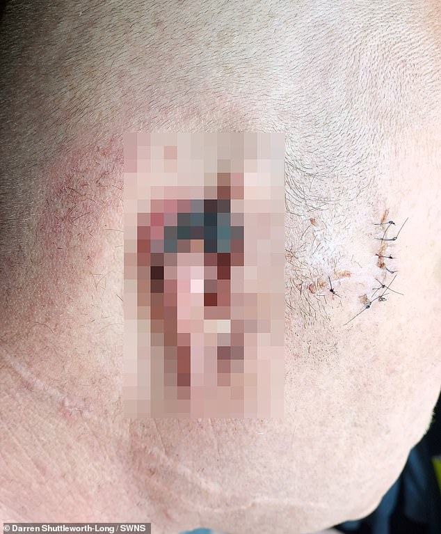 The dog-sitter was taken to hospital and had what was left of his ear stitched up, he said: 'The tissue had to come off - there was nothing to attach it to'