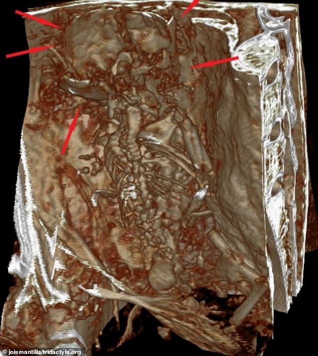 The CT scan claims to show details of the fetus' bones, capturing its ribs, legs and skull