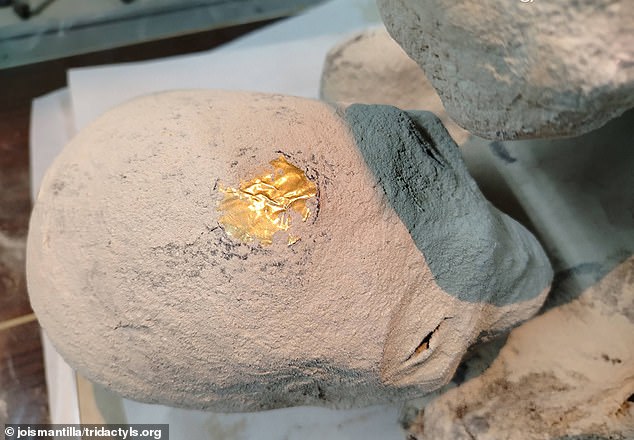 Scientists also snapped an image of a metal-like object on the top of Montserrat's head, but they do not understand the purpose of the implant yet