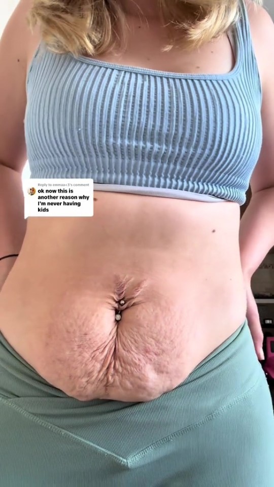 Postpartum belly with loose skin and a navel piercing.