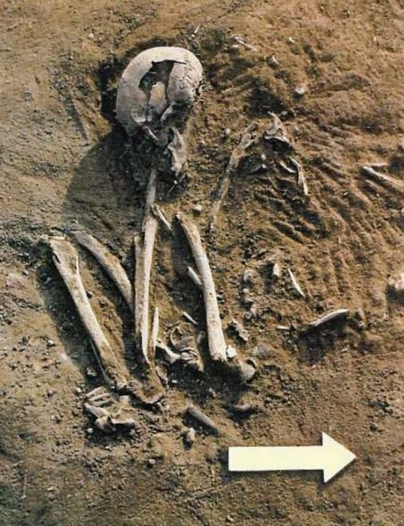Excavated human remains at Checua.