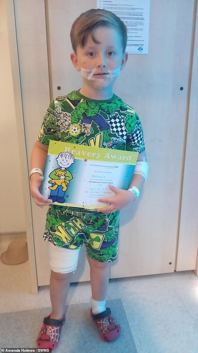 Antonio in hospital with his 'bravery award' after his wounds were treated and bandaged at Royal Manchester Children's Hospital