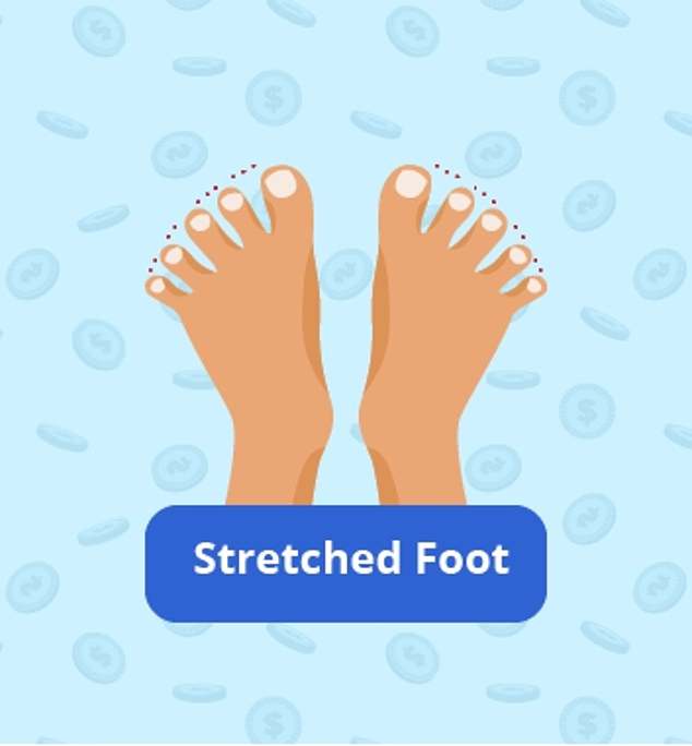Stretched feet are characterised by separated toes caused by wide set metatarsal bones