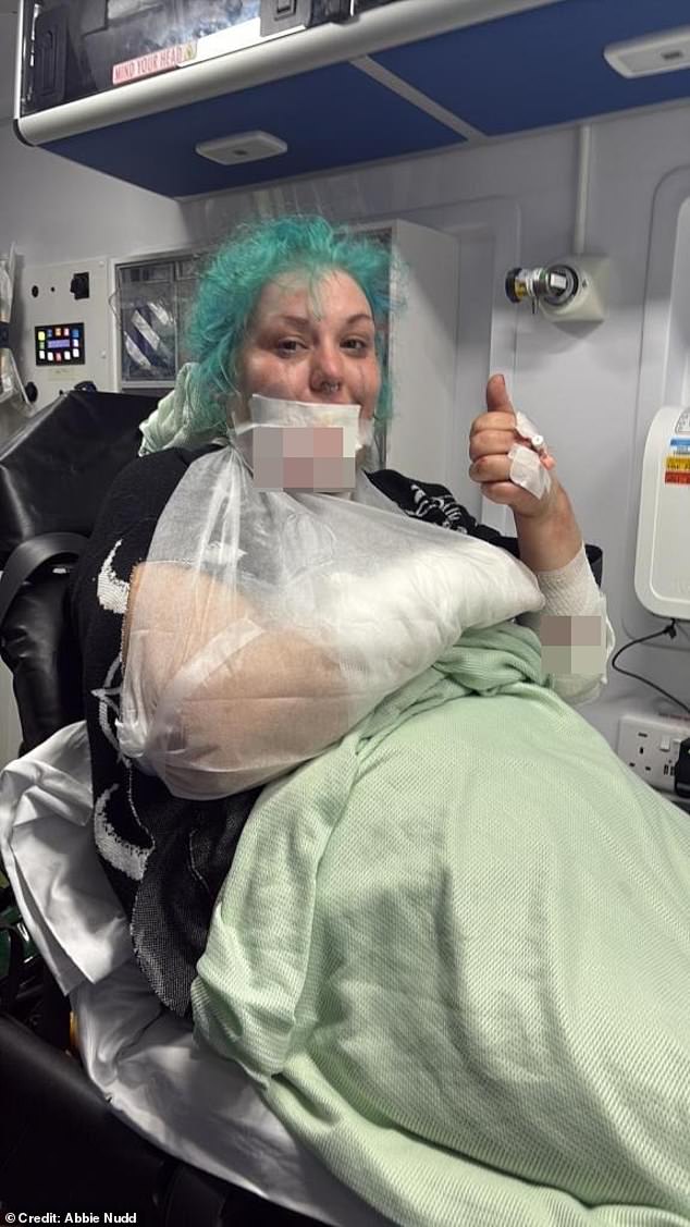 The dog had been sitting nicely and allowing Ms Nudd (above) and Lydia to stroke it, but the canine's mood quickly changed and its demeanor shifted - the attack left Ms Nudd with bite marks to the face, both arms and torso before it chewed through her wrist bone