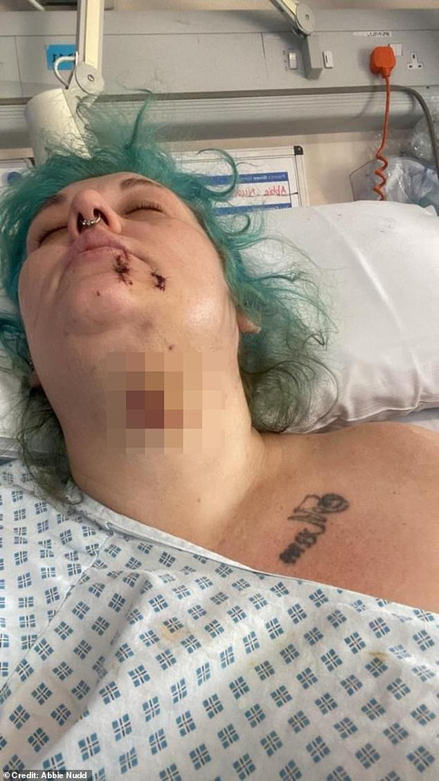 Ms Nudd said she eventually 'decided to give up' and allowed the dog to bite her so that it would not go for her niece again