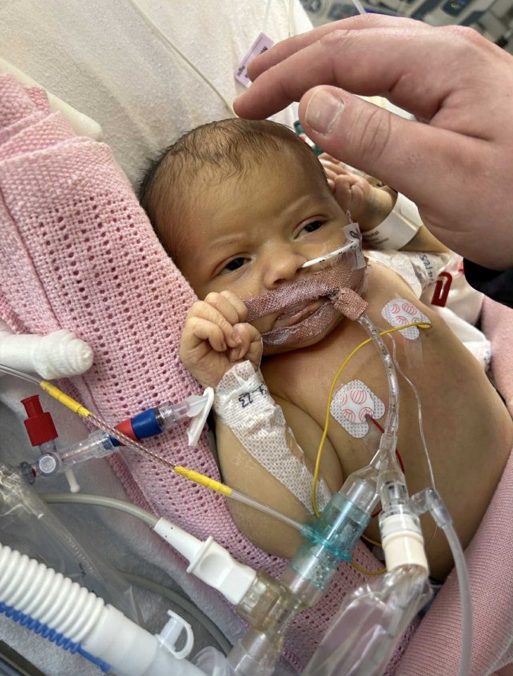 A newborn baby girl in a hospital bed with medical tubes attached.