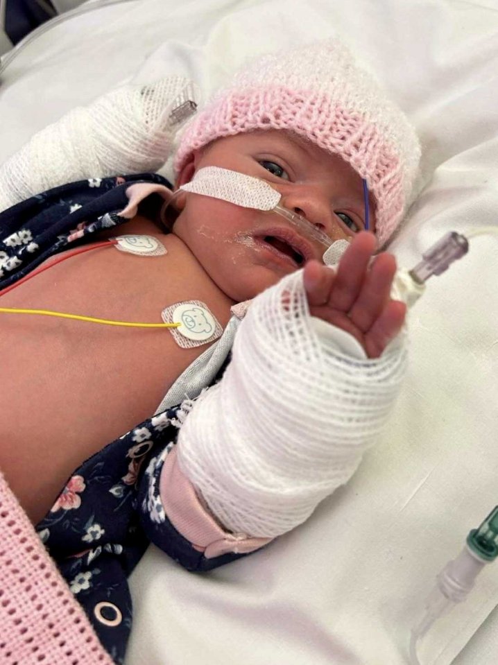 Newborn baby in hospital with IV lines.