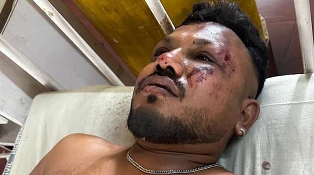 Viswashkumar Ramesh video called his family with a bloodied face after walking away from the burning aircraft