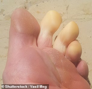 If your toes feel unusually cold and lose their colour it could be a sign they are not getting proper circulation