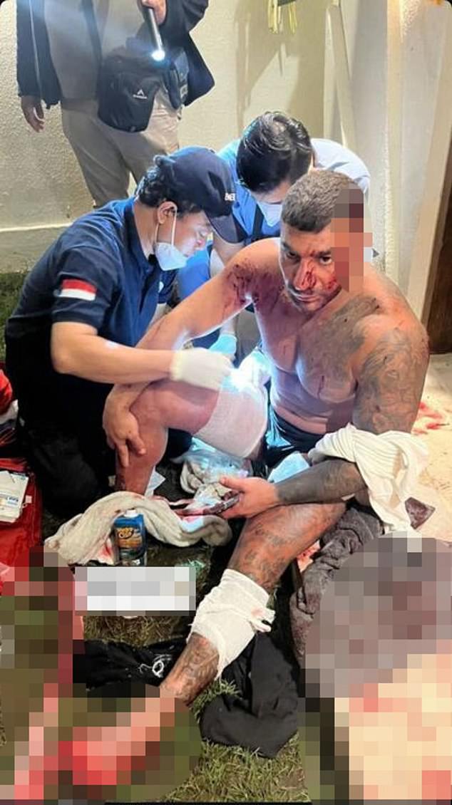 Sanar Ghanim is pictured after the attack in Bali