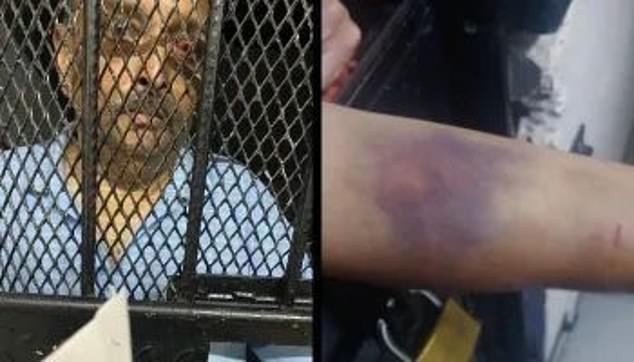 He says he suffered serious injuries at the hands of the group of thugs that allegedly kidnapped him