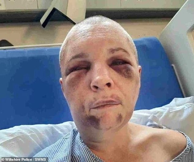 Hitt's terrified victim was subjected to a relentless 10-hour nightmare on February 21 this year, during which he kept her prisoner at his home, repeatedly assaulted her, used a blow torch on her, and forcibly shaved her head