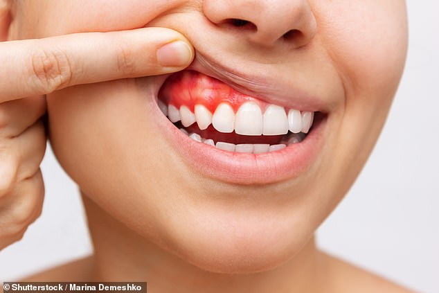 The Association of Dental Groups said there is currently a backlog of 6,000 fully-trained overseas dentists in the queue to register with the General Dental Council
