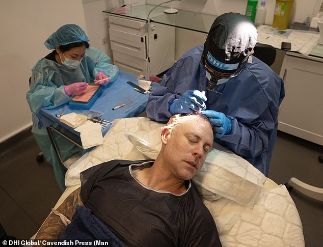 The former pro footballer, 44, had more than 4,000 hairs implanted into the thinning areas of his scalp at DHI Global's Clinic in central London nine months ago (pictured during the surgery)