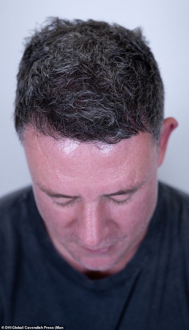 The results of Wayne's transplant nine months after the procedure