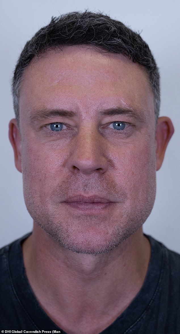 Revealing the outcome of the transplant in new images, Wayne admitted he was 'buzzing' with the result which has been a big boost to his confidence
