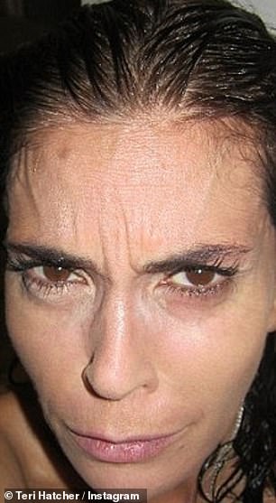 Teri previously provided picture evidence to prove to her fans she no longer touches filler or Botox