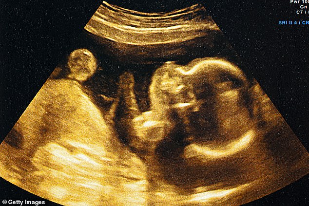 At present, abortion cannot legally be approved by doctors if the foetus is more than 24 weeks old, which is about the time at which it is capable of surviving outside the womb