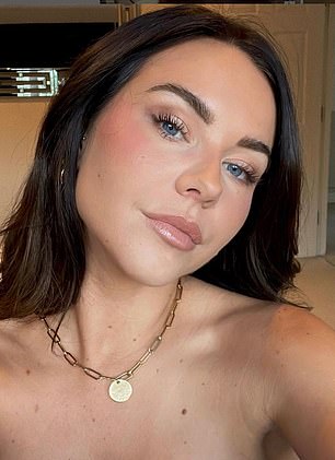 Shelby opened up about having her fillers removed in 2019 after quitting The Only Way Is Essex for motherhood (seen after)