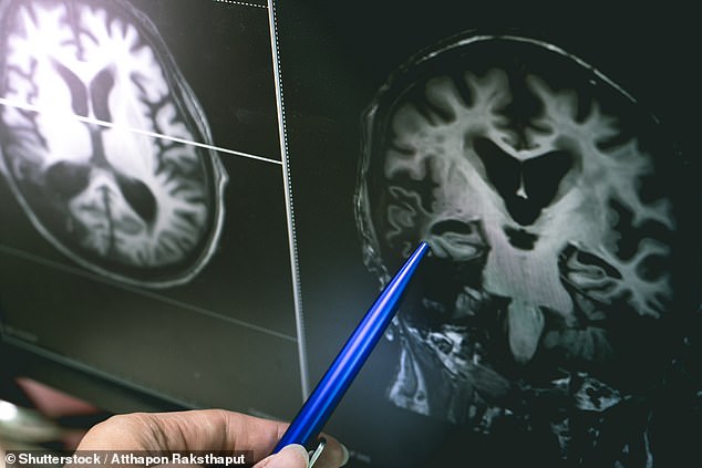Researchers tracked more than 10,000 people aged over 50 and found those with higher levels of wellbeing were more likely to have better scores on memory tests