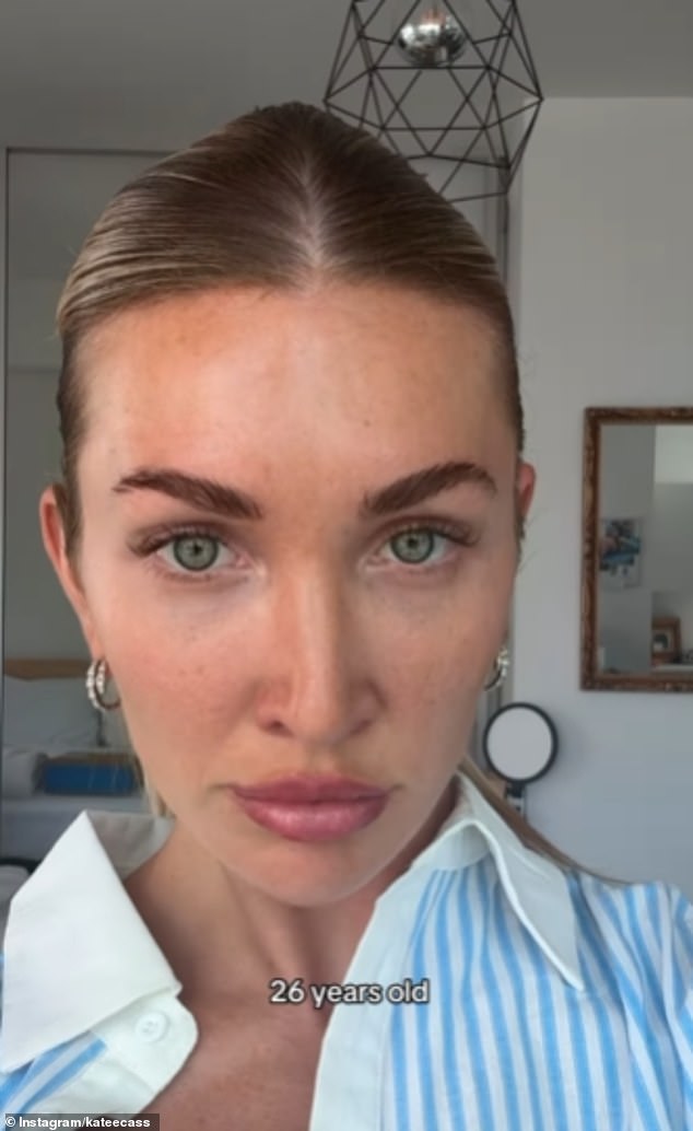 Kate revealed she later got her cheek and chin filler removed before getting different amounts re-injected, while she did the same with her lip filler, and now also has Botox (pictured now)