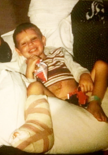 Young boy in hospital bed with leg cast.