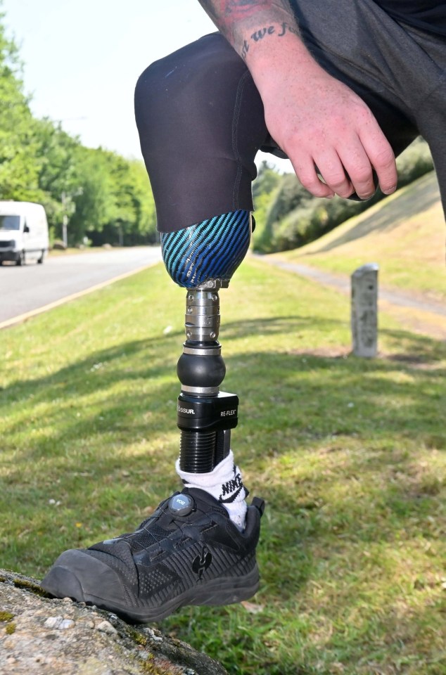 Close-up of a man's prosthetic leg.