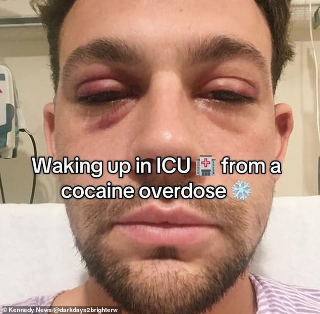 A shocking photo taken in August 2021 shows Dave with bloodshot 'devil' eyes after waking up from a coma in ICU following a drug-induced psychosis