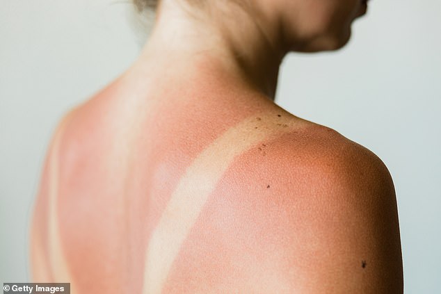 Studies show that just five sunburns can lead to a doubling in the risk of developing melanoma.