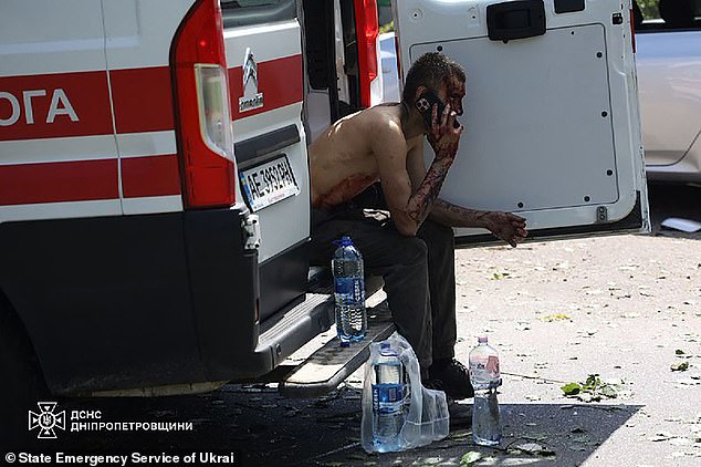 A wounded man speaking on a mobile phone following a Russian missile strike in the eastern Ukrainian city of Dnipro on June 24 2025
