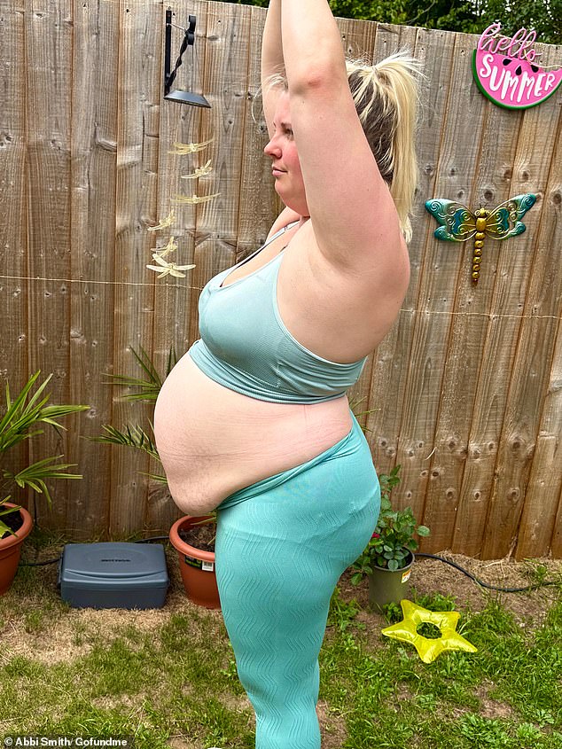 Aside from back pain and discomfort, Abbi said she has also become more self-conscious because of the 'bulge' caused by her condition