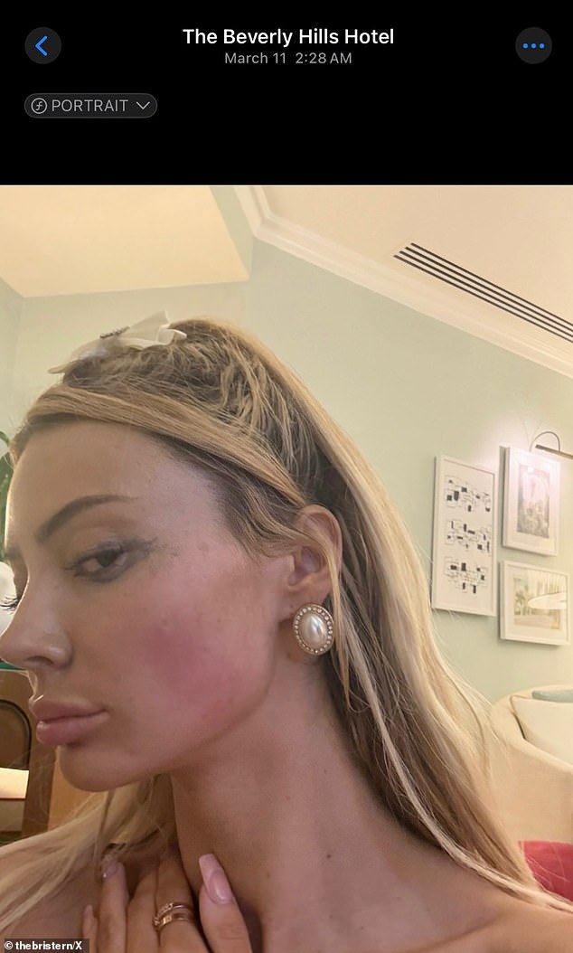Stern says she was physically abused by Tate, including being choked, during a sex session on March 11