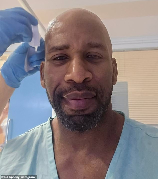 Radio 2 star DJ Spoony revealed he was hospitalised over Christmas for emergency brain surgery as he shared a slew of photographs during the process