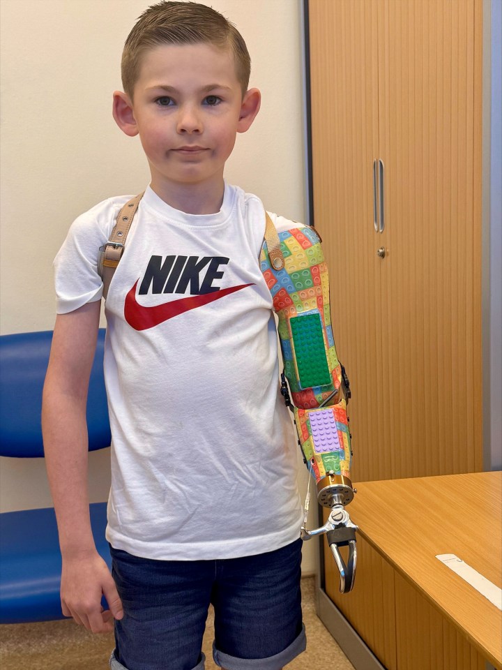 Boy with Lego-themed prosthetic arm.