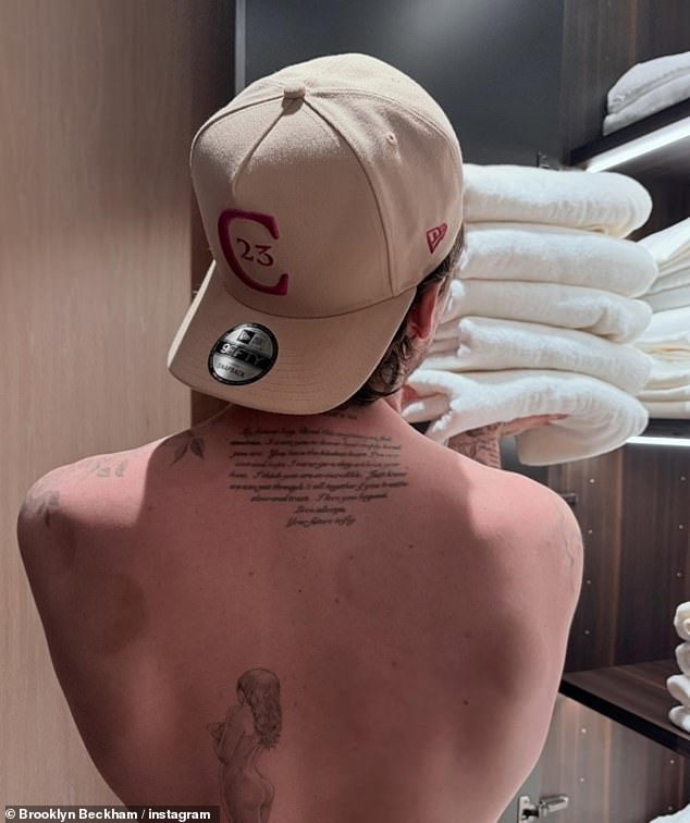 Elsewhere on Wednesday, Brooklyn appeared to debut a new tattoo as he shared a shirtless snap - which also seemed to show him with cupping marks