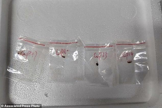 A pair of Chinese researchers have been charged in Michigan for allegedly smuggling a biological pathogen (pictured) into the US to study at the University of Michigan