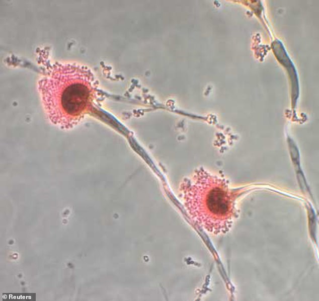 Aspergillus fungus is a toxic fungus that produces aflatoxin, one of the most powerful naturally occurring carcinogens. This can cause cancers and disorders of the lung, liver, spleen, stomach, colon and kidney.