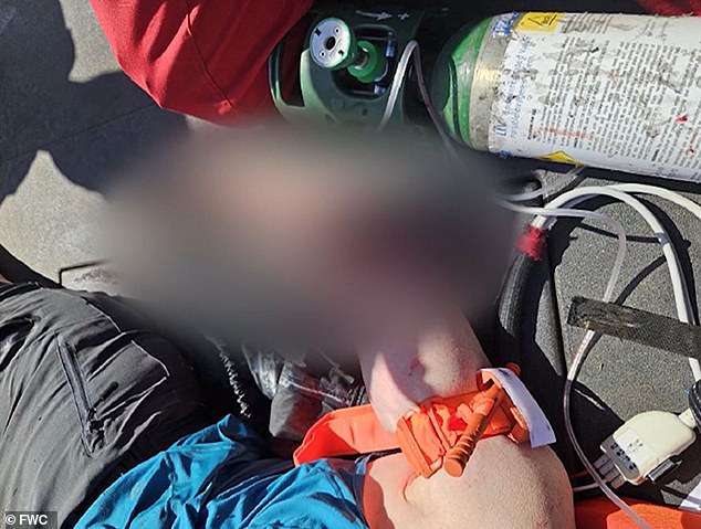 Christiane suffered severe injuries to her right upper forearm (pictured) and two puncture wounds just below her elbow