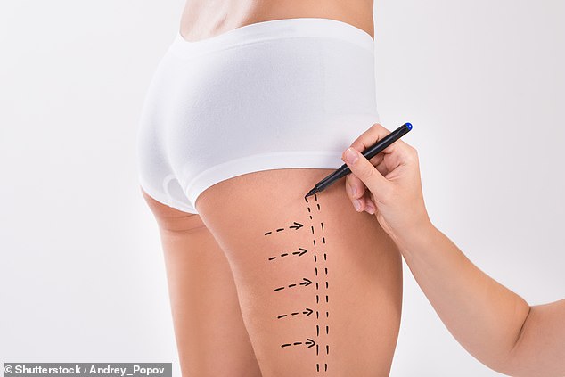 Untrained practitioners are offering fat jabs, butt lifts and Botox in public toilets in a ¿Wild West¿ procedures market