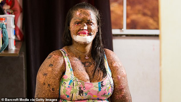 Despite her health battles, Karine said her pregnancy was 'really smooth' and that Zaya has a less than one per cent chance of developing the same disease as her mum