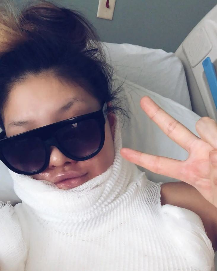 A woman with bandages on her face and upper body gives a peace sign.
