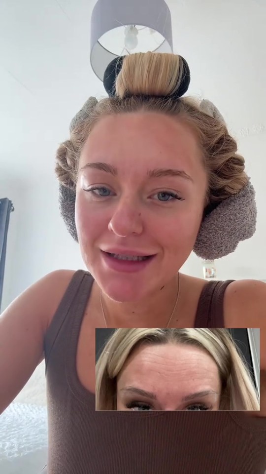 Woman with hair rollers showing before and after forehead wrinkles.