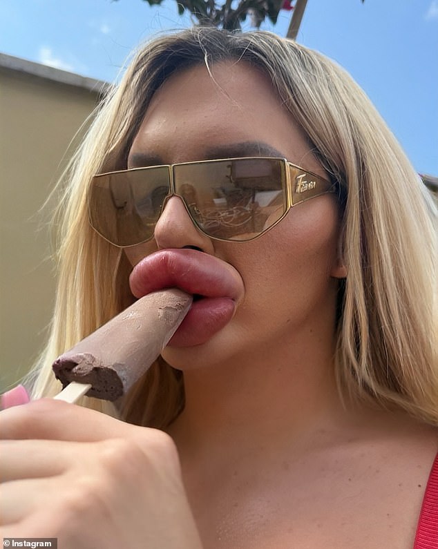 A transgender woman who has gotten so much lip filler she now has breathing problems and can't close her mouth has insisted that she's far from done
