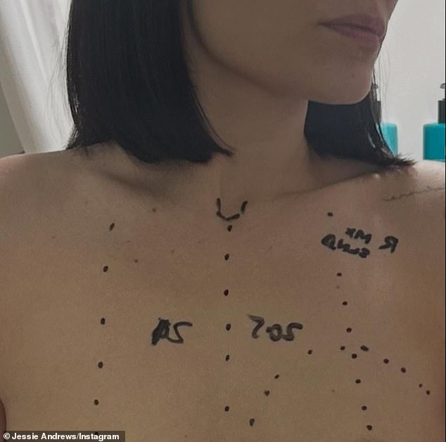 Jessie revealed her 'early' cancer diagnsosis earlier this month, and told fans she would be undergoing surgery
