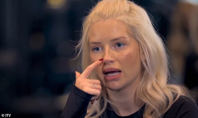 Lottie Moss has revealed she always felt 'compared' to her supermodel sister Kate as she admitted she would try weight loss jabs after suffering a seizure