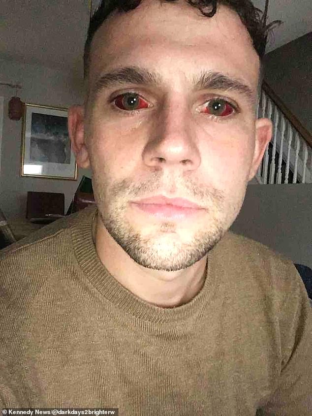Dave Mullen, from Salisbury in Wiltshire, was almost killed by a five-day cocaine bender- leaving him in a coma and with such bloodshot eyes that elderly people thought he was the 'devil'