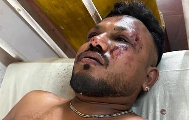 Vishwash Kumar Ramesh (pictured) is one of a very few individuals who has experienced something miraculous - surviving a plane crash. He was the only man to survive Air India's devastating plane crash on Thursday