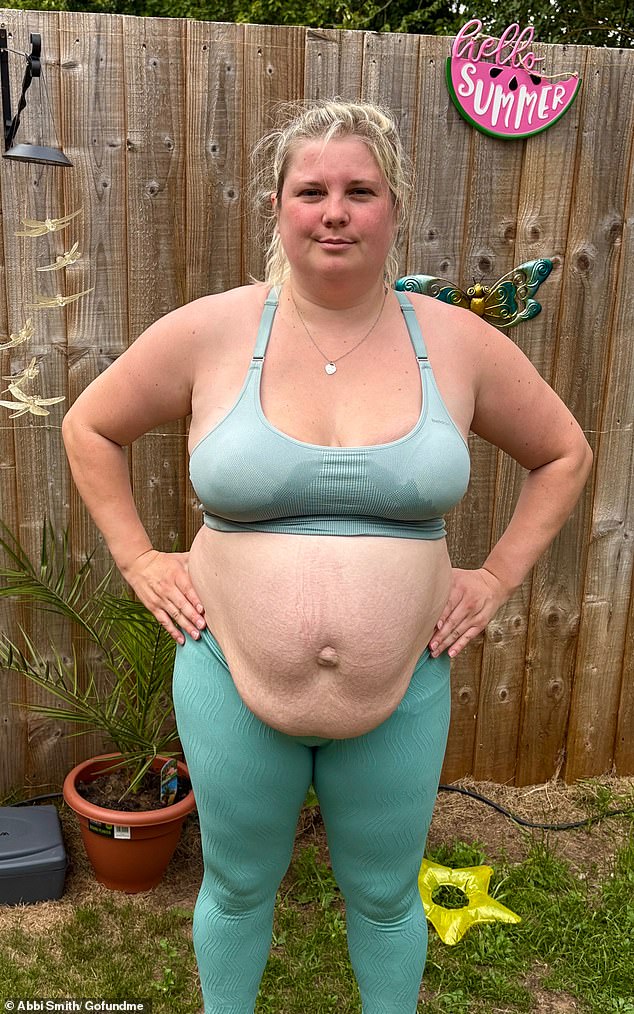 Abbi Smith gained five stone and an unsightly bulge after her pregnancy caused an umbilical hernia and diastasis recti, a condition in which the stomach muscles separate