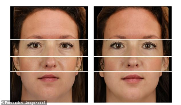 Researchers from Tilburg University showed over 2,700 participants photos of people with and without the treatment, and asked them to rate them across a number of measures. Pictured: face regions of four different individuals merged to protect anonymity